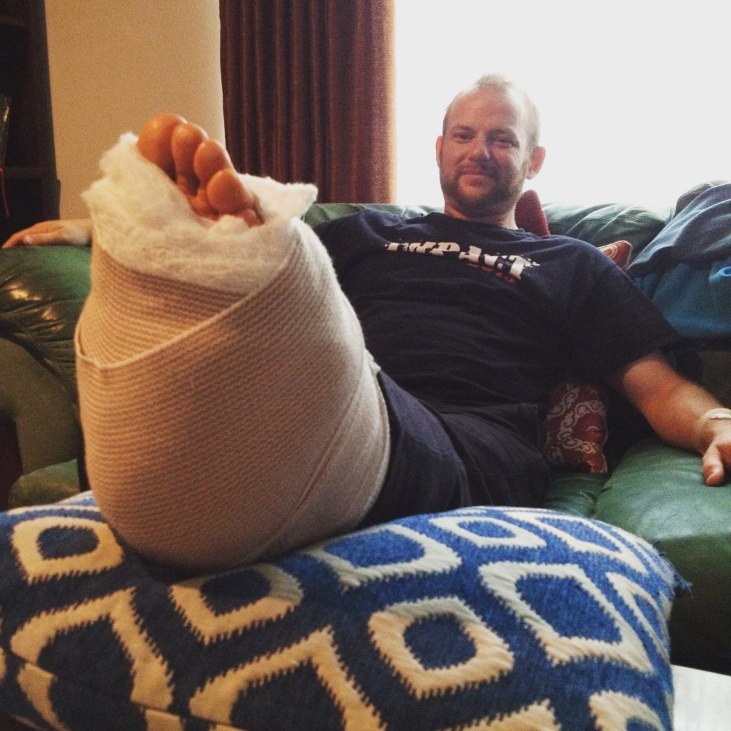 2016-8-12 Mike's Broken Foot Post-Surgery